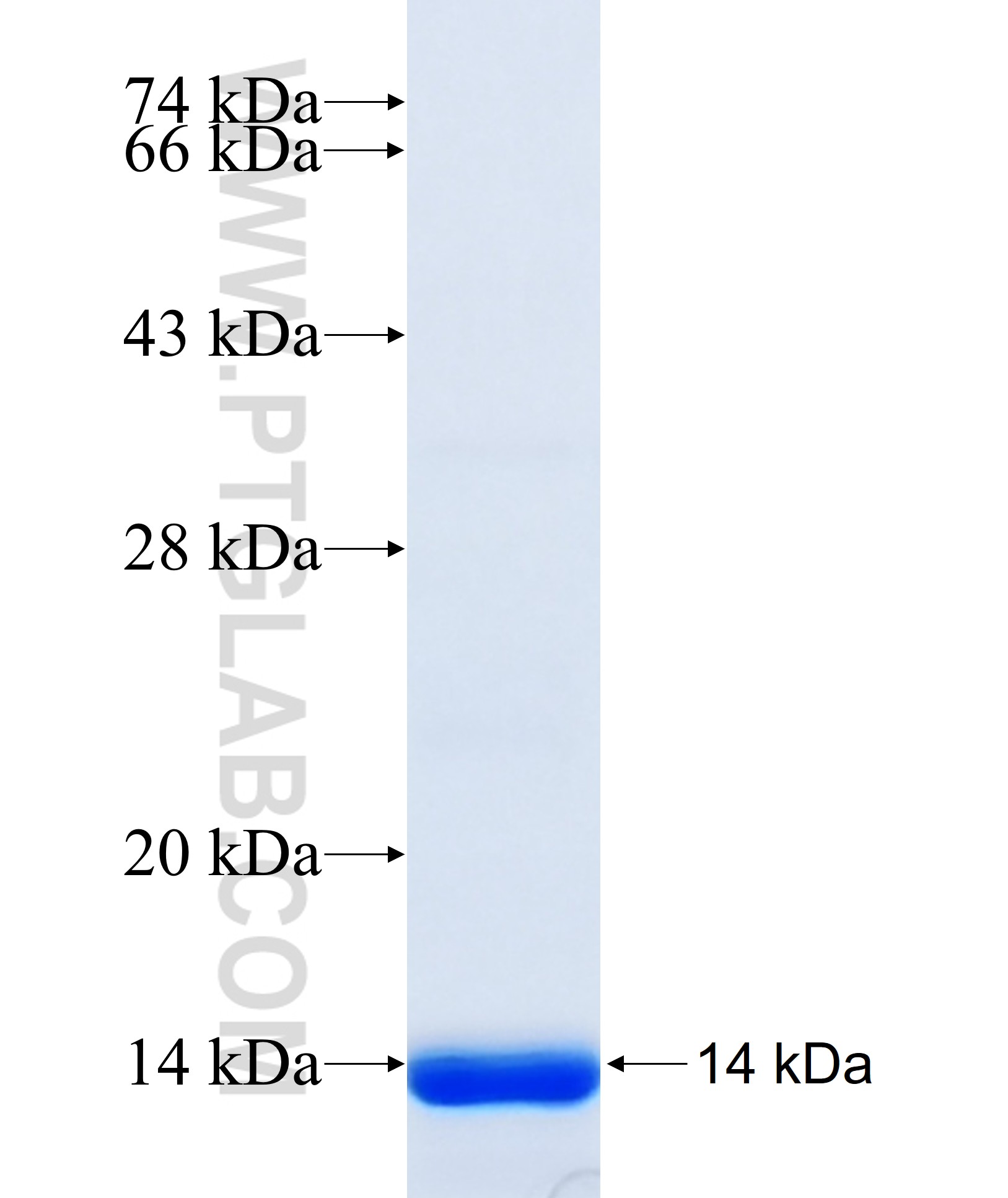 COL10A1 fusion protein Ag34888 SDS-PAGE COL10A1 fusion protein Ag34888 SDS-PAGE