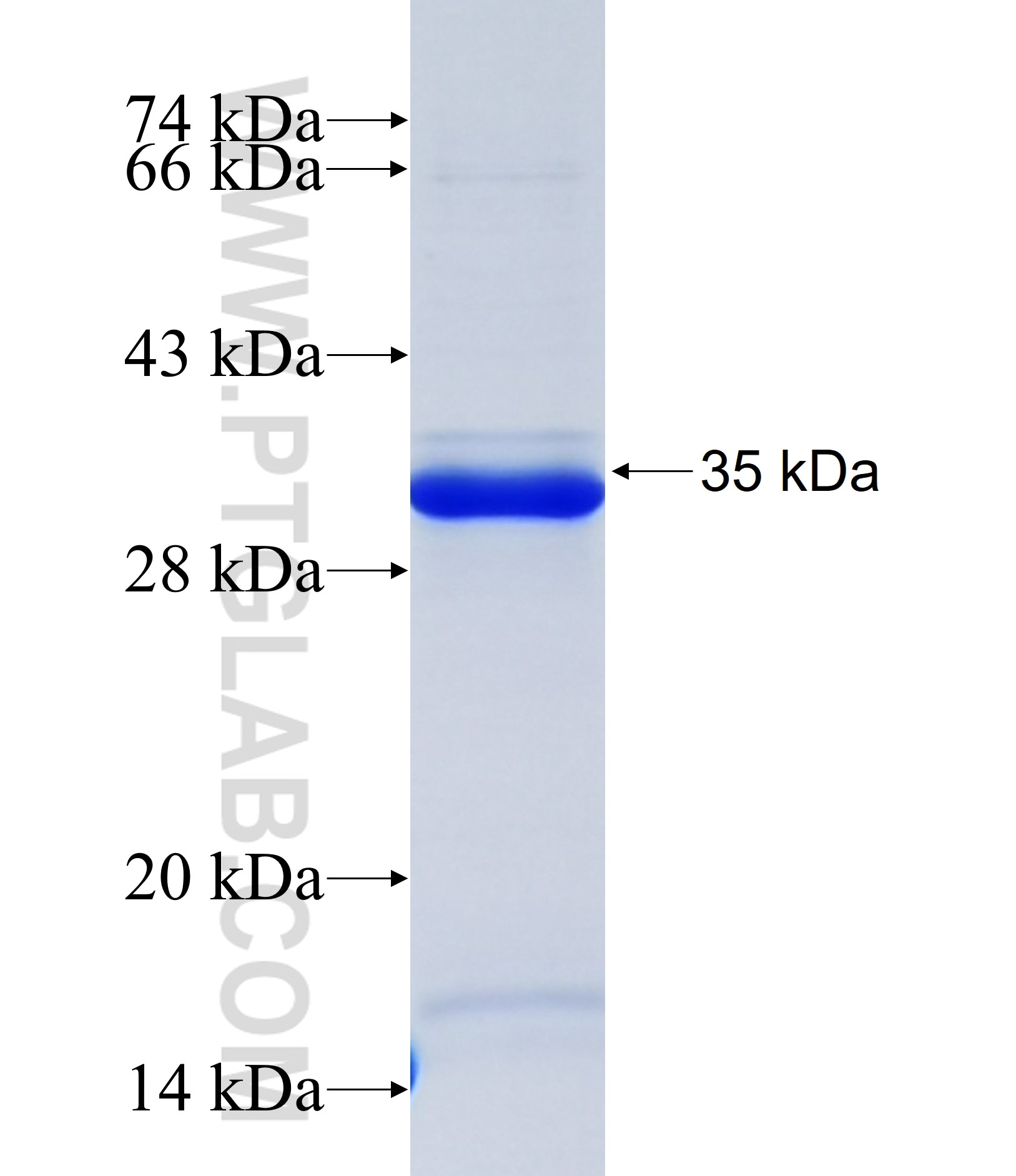 COL11A1 fusion protein Ag38139 SDS-PAGE COL11A1 fusion protein Ag38139 SDS-PAGE