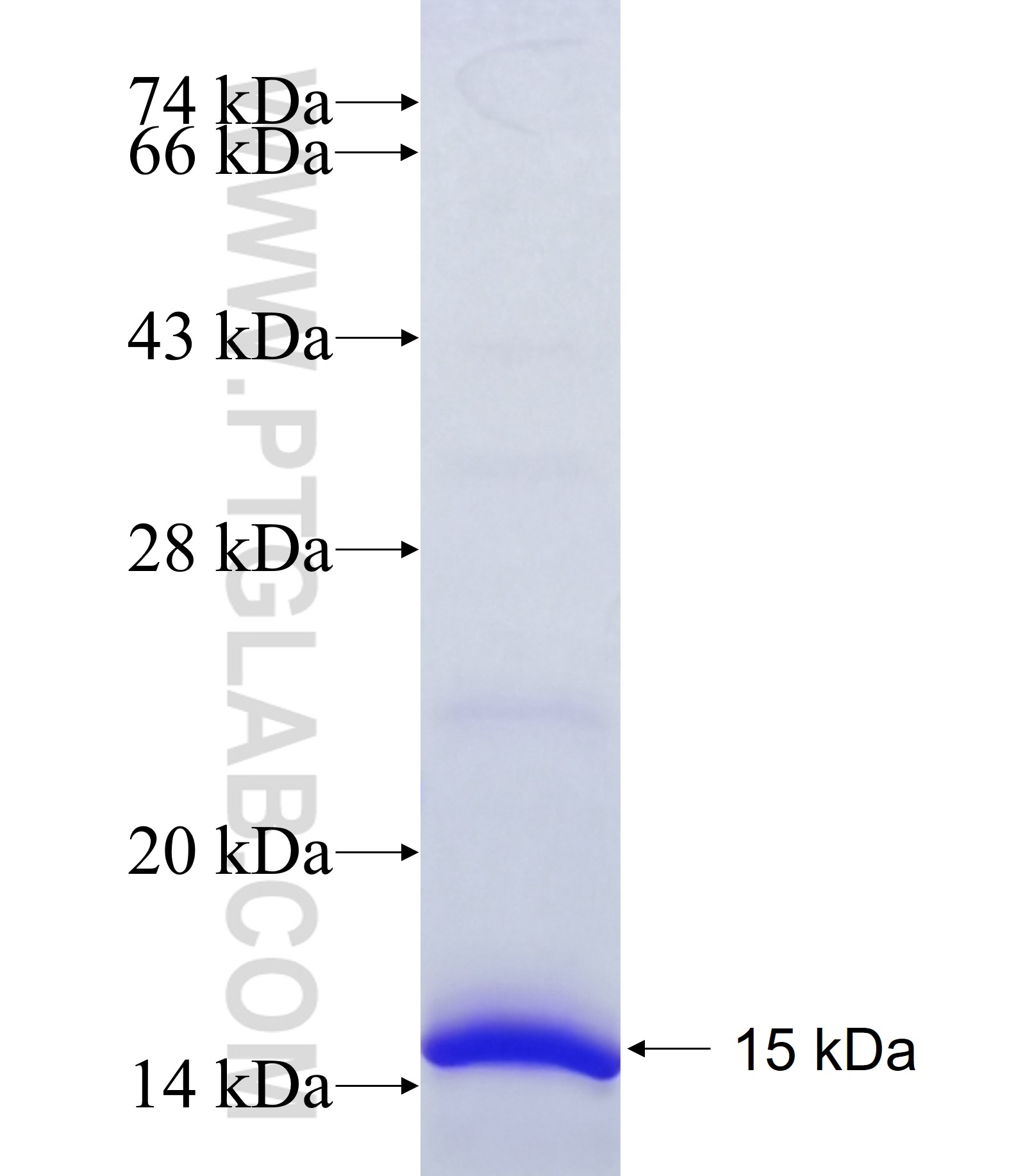 COL11A1 fusion protein Ag39133 SDS-PAGE COL11A1 fusion protein Ag39133 SDS-PAGE