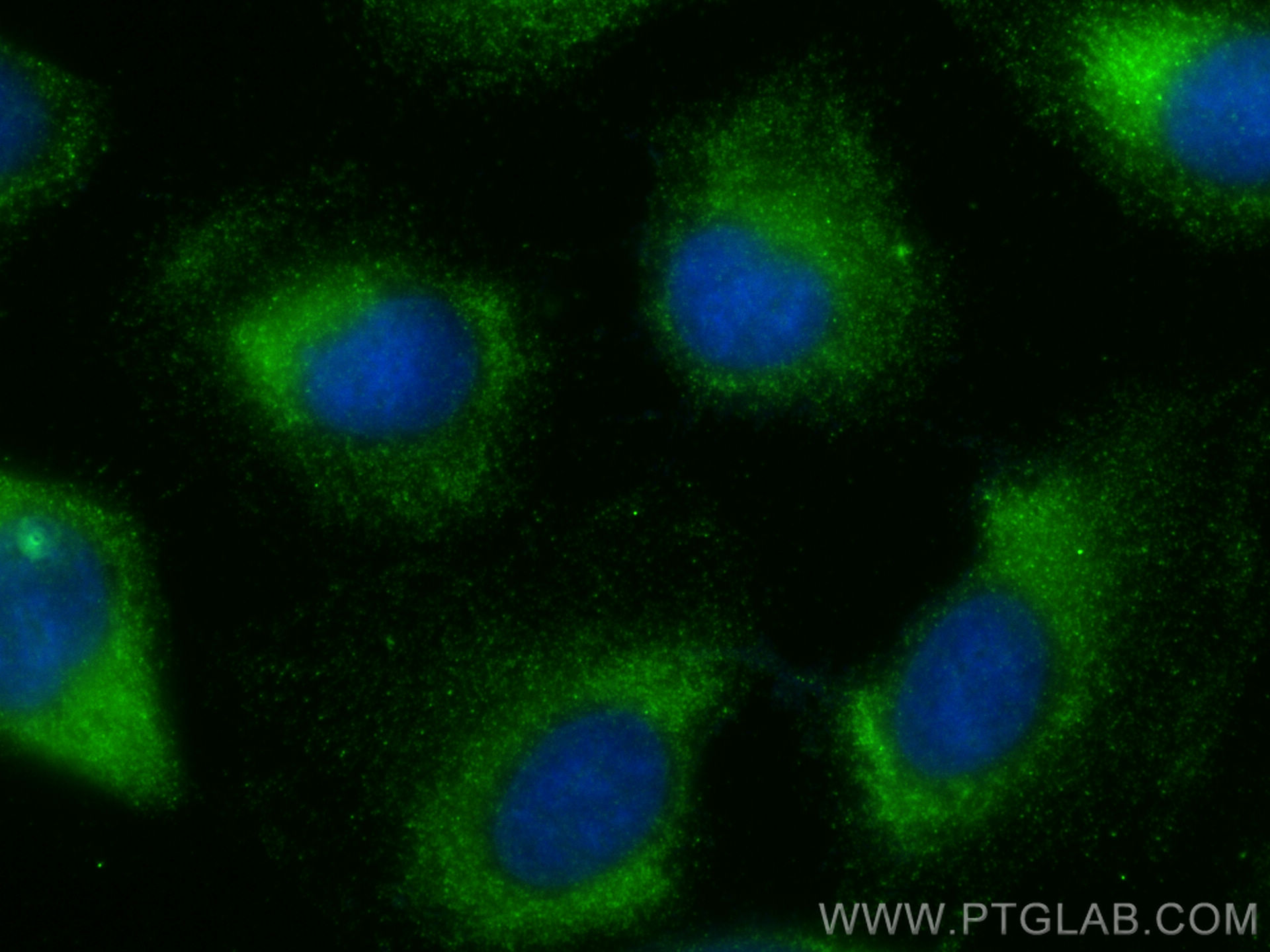 IF Staining of U2OS using 30045-1-AP