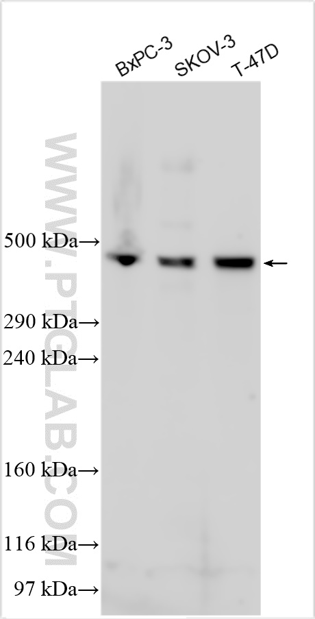 WB analysis using 51113-1-AP