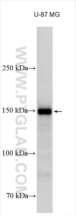 WB analysis using 14695-1-AP