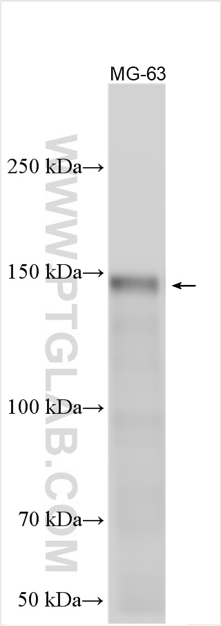 WB analysis using 14695-1-AP