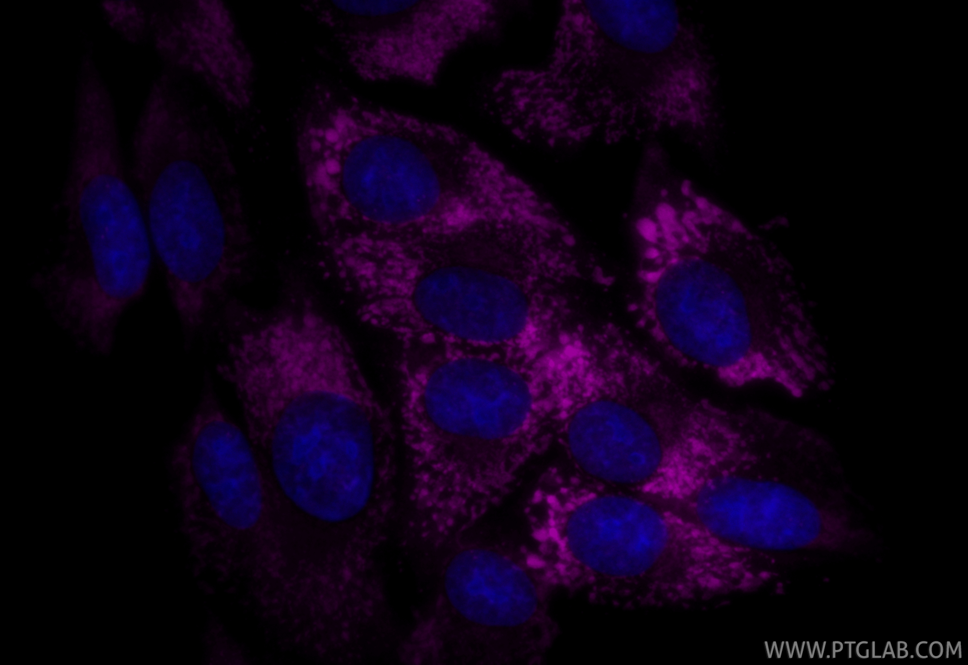 IF Staining of HSC-T6 using CL647-83752-5 IF Staining of HSC-T6 using CL647-83752-5