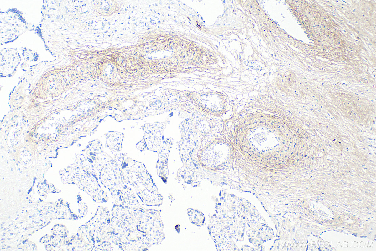Immunohistochemical analysis of paraffin-embedded human placenta tissue slide using <a class='green' href='/productredirect?CatalogNo=83752-5-RR' target='_blank'>83752-5-RR</a> (Collagen Type I antibody) at dilution of 1:1000 (under 10x lens). Heat mediated antigen retrieval with Tris-EDTA buffer (pH 9.0). This data was developed using the same antibody clone with 83752-5-PBS in a different storage buffer formulation. IHC staining of human placenta using 83752-5-RR (same clone as 83752-5-PBS)