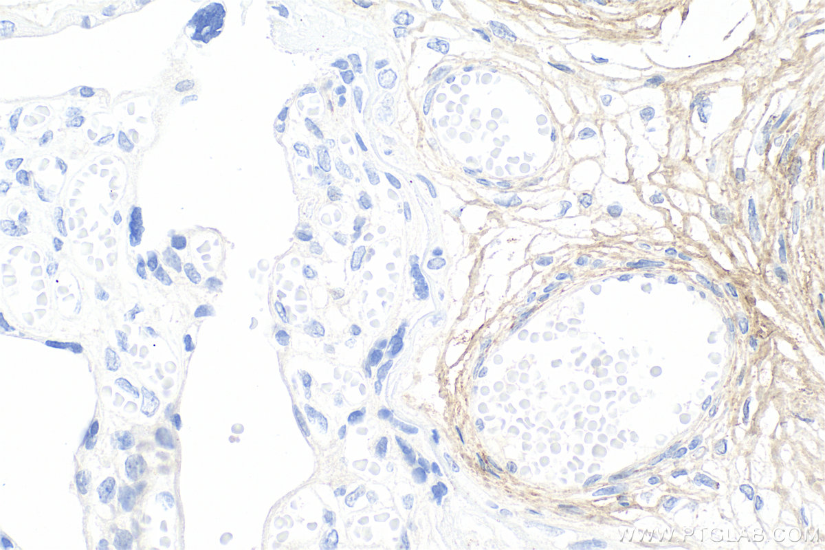 Immunohistochemical analysis of paraffin-embedded human placenta tissue slide using <a class='green' href='/productredirect?CatalogNo=83752-5-RR' target='_blank'>83752-5-RR</a> (Collagen Type I antibody) at dilution of 1:1000 (under 40x lens). Heat mediated antigen retrieval with Tris-EDTA buffer (pH 9.0). This data was developed using the same antibody clone with 83752-5-PBS in a different storage buffer formulation. IHC staining of human placenta using 83752-5-RR (same clone as 83752-5-PBS)