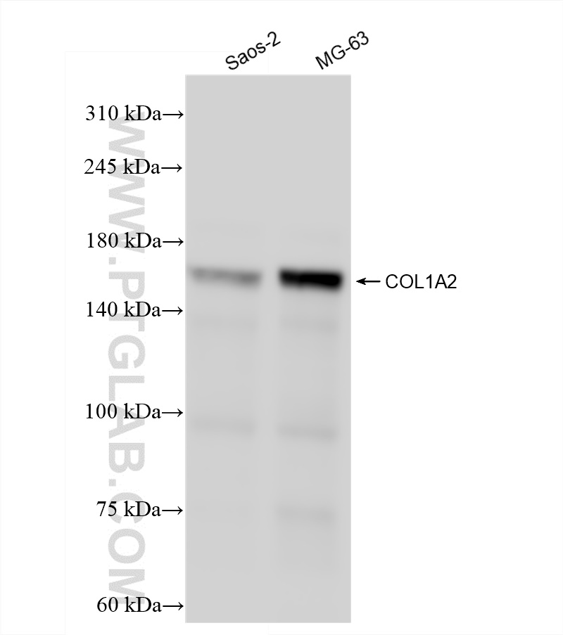 WB analysis of Saos-2 using 83752-5-RR
