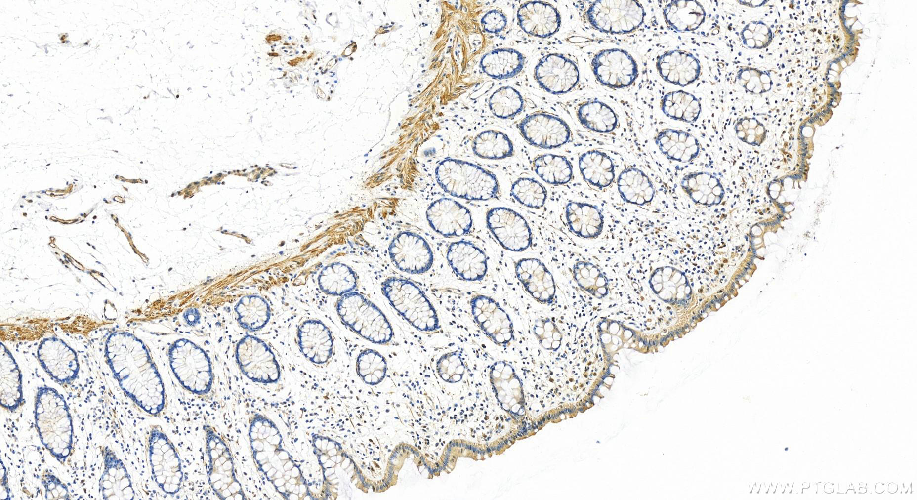 IHC staining of human colon using 21106-1-AP