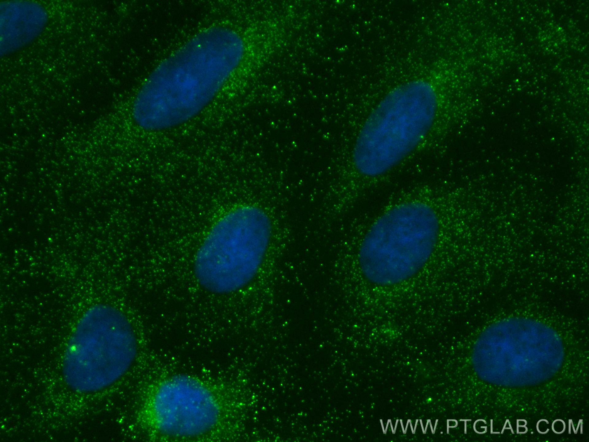 IF Staining of U2OS using 21106-1-AP