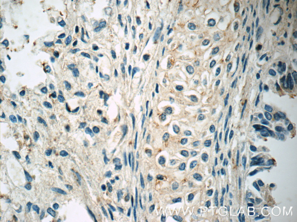 IHC staining of human lung using 15943-1-AP