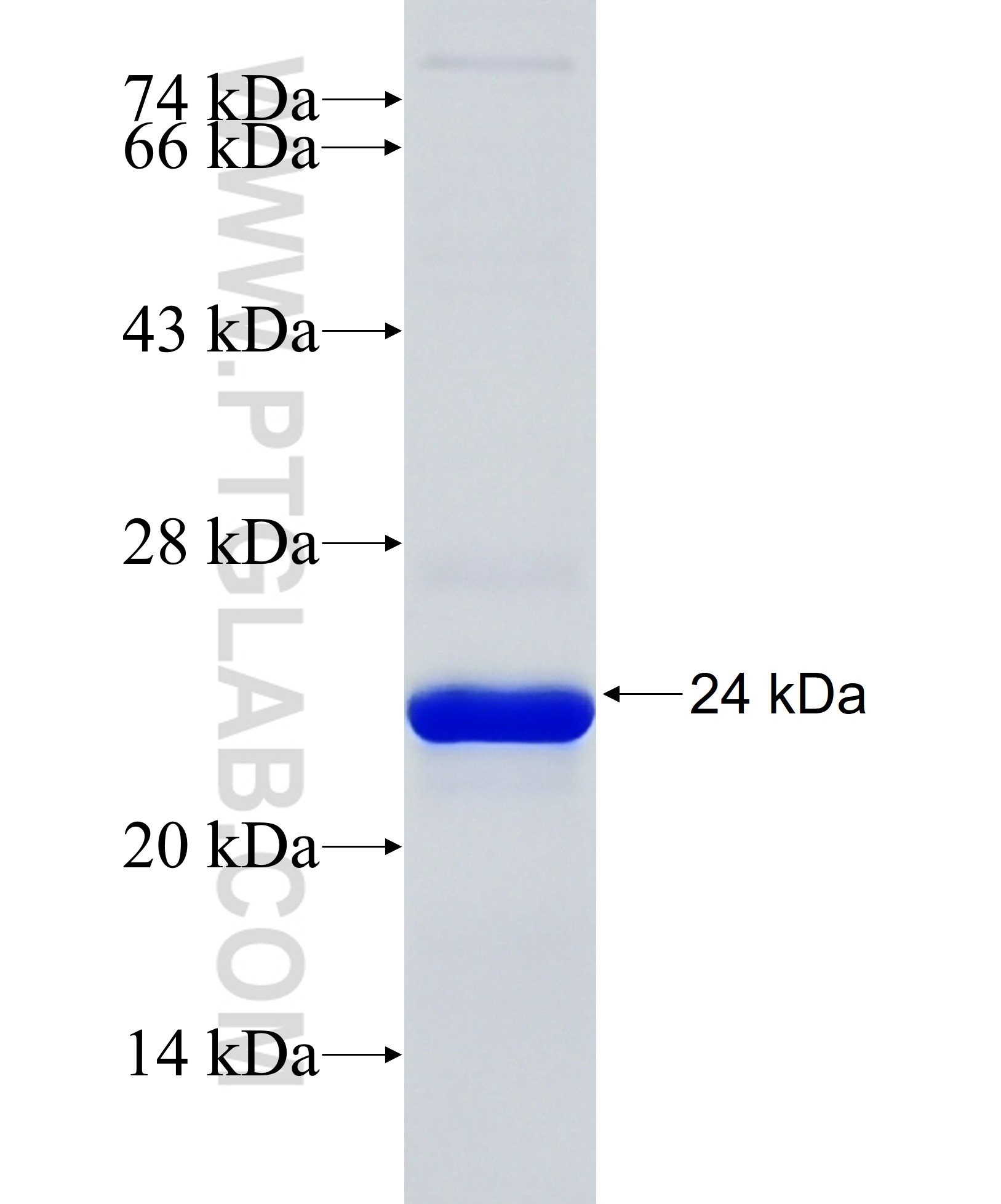 COL2A1 fusion protein Ag31576 SDS-PAGE
