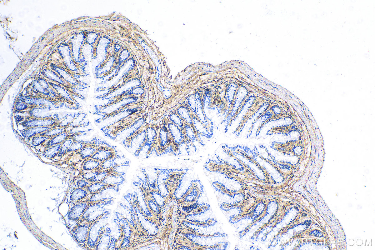 IHC staining of mouse colon using 22734-1-AP