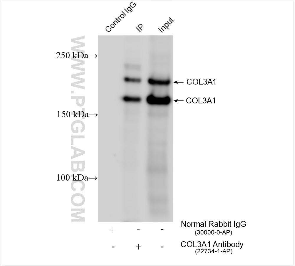 IP experiment of mouse skin using 22734-1-AP (same clone as 22734-1-PBS)
