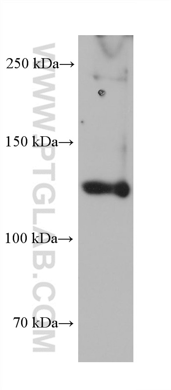 WB analysis of human placenta using 68320-1-Ig