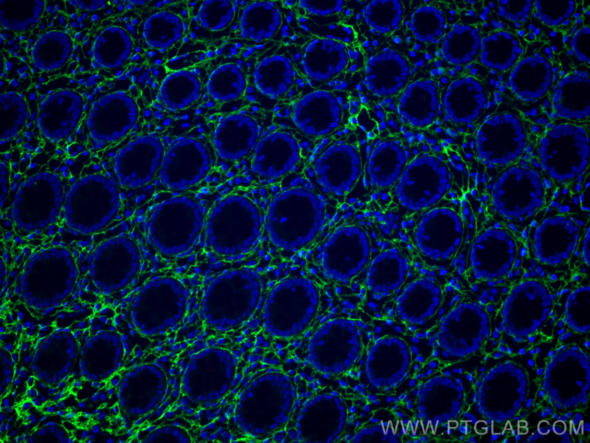 IF Staining of human colon using 80009-1-RR