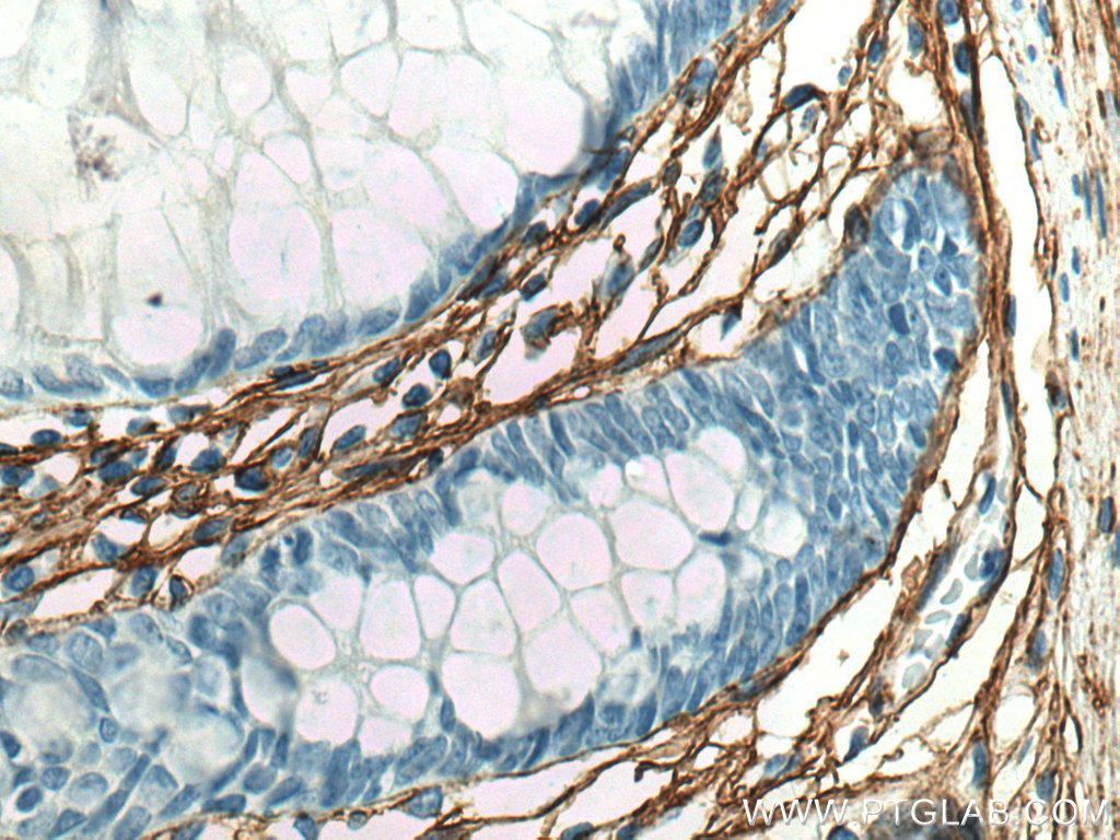 IHC staining of human colon using 80009-1-RR