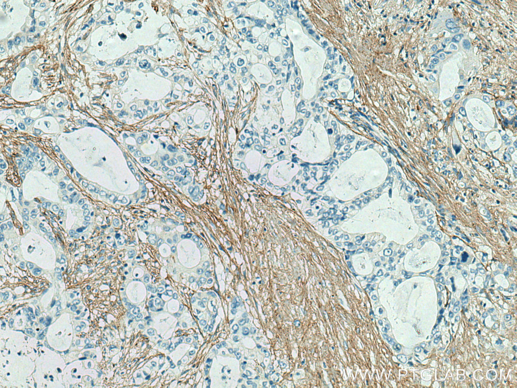 Collagen Type III (N-terminal)