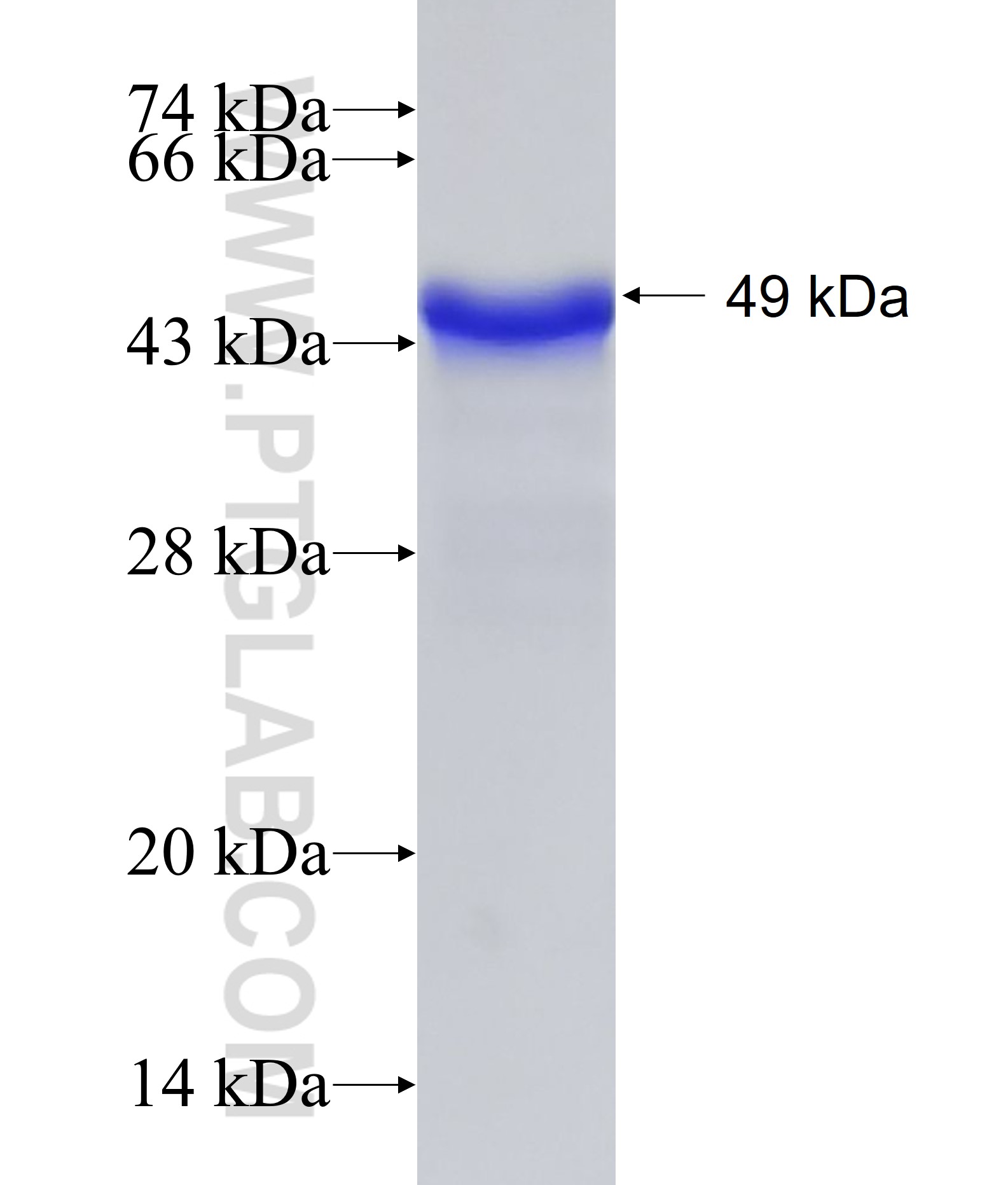 COL3A1 fusion protein Ag18658 SDS-PAGE