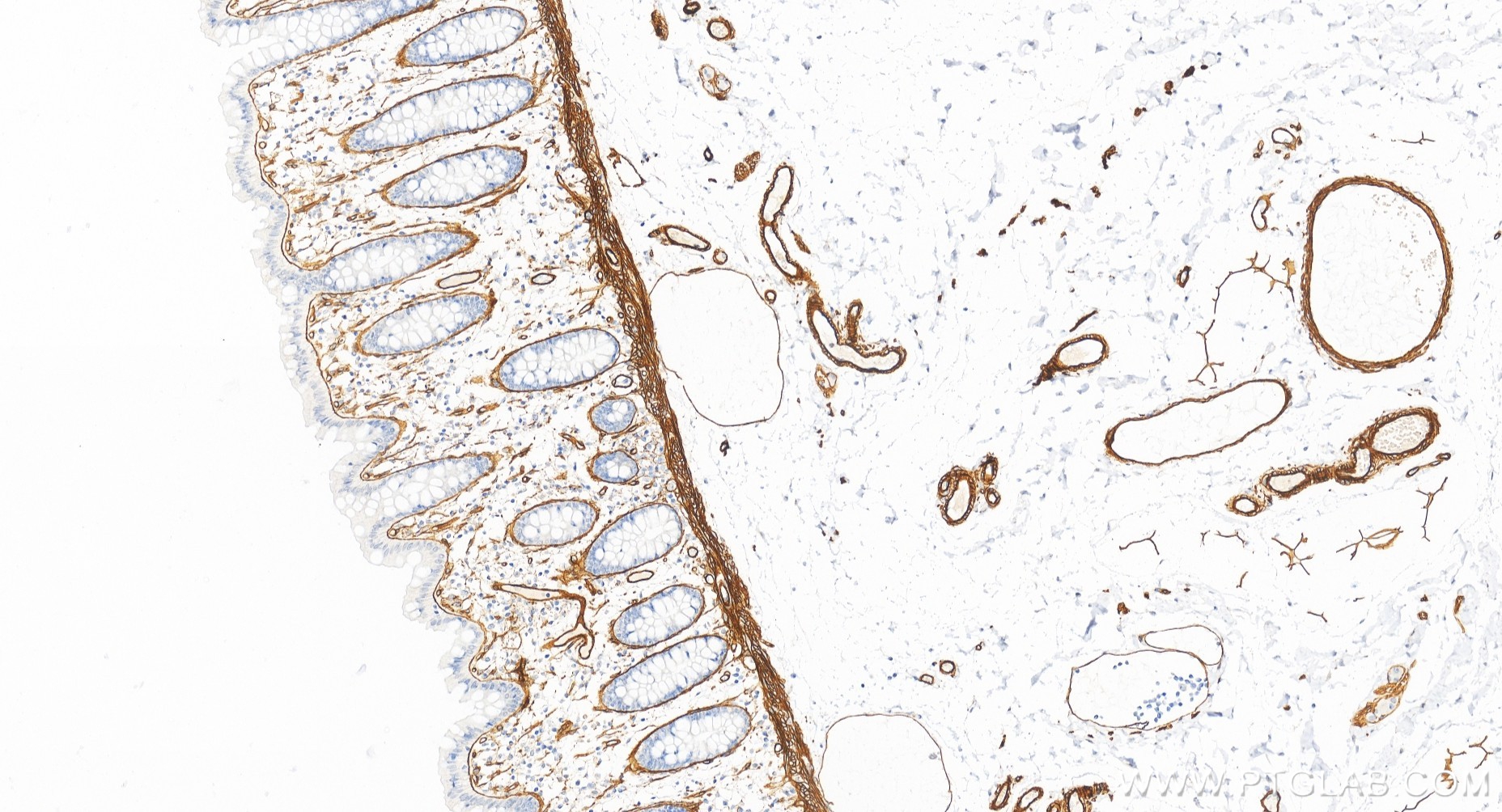Immunohistochemical analysis of paraffin-embedded human colon tissue slide using <a class='green' href='/productredirect?CatalogNo=85256-4-RR' target='_blank'>85256-4-RR</a> (COL4A1 antibody) at dilution of 1:1500 (under 20x lens). Heat mediated antigen retrieval with Tris-EDTA buffer (pH 9.0). This data was developed using the same antibody clone with 85256-4-PBS in a different storage buffer formulation. IHC staining of human colon using 85256-4-RR (same clone as 85256-4-PBS)