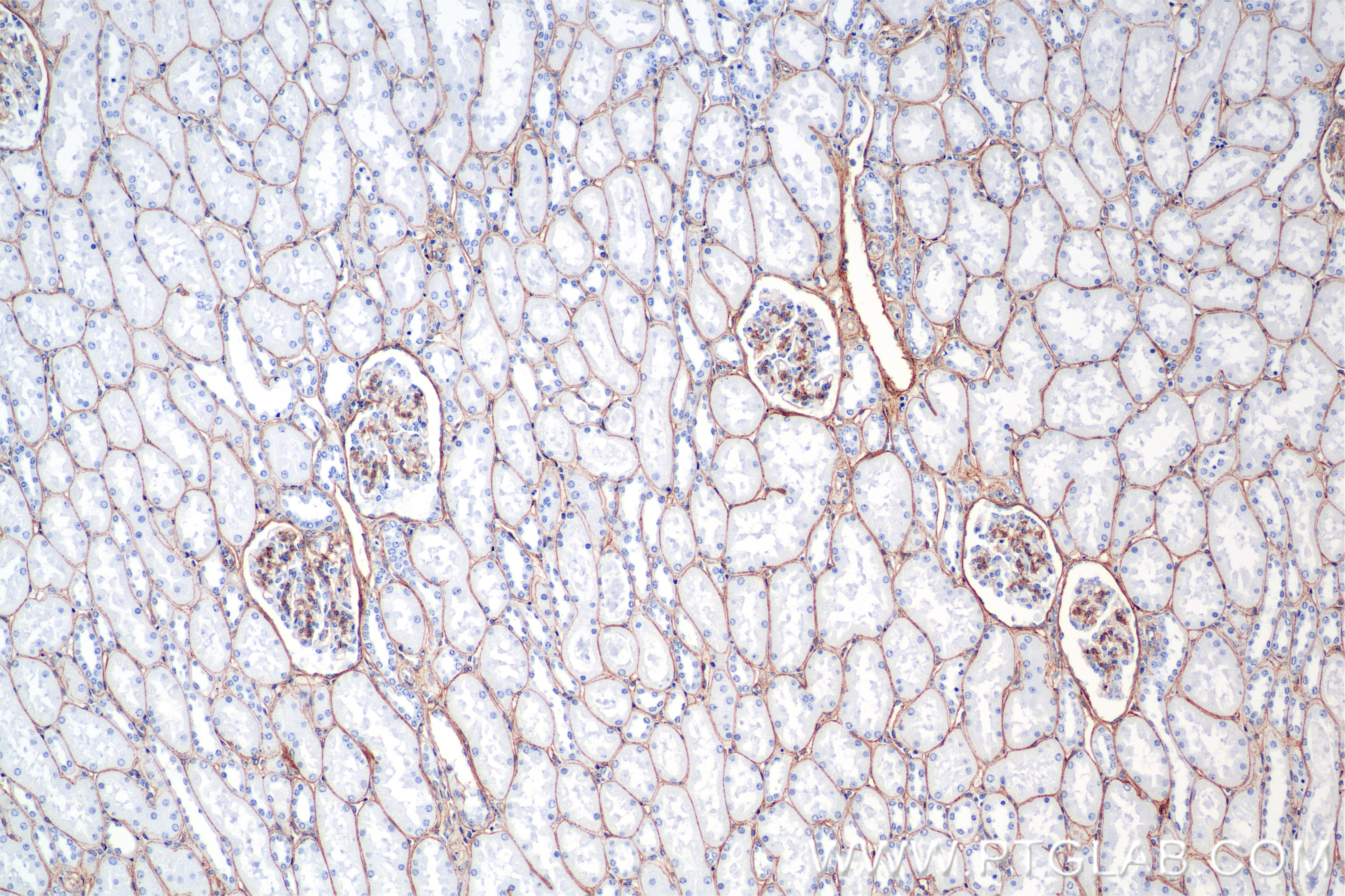Immunohistochemical analysis of paraffin-embedded human kidney tissue slide using <a class='green' href='/productredirect?CatalogNo=85256-4-RR' target='_blank'>85256-4-RR</a> (COL4A1 antibody) at dilution of 1:1500 (under 10x lens). Heat mediated antigen retrieval with Tris-EDTA buffer (pH 9.0). This data was developed using the same antibody clone with 85256-4-PBS in a different storage buffer formulation. IHC staining of human kidney using 85256-4-RR (same clone as 85256-4-PBS)