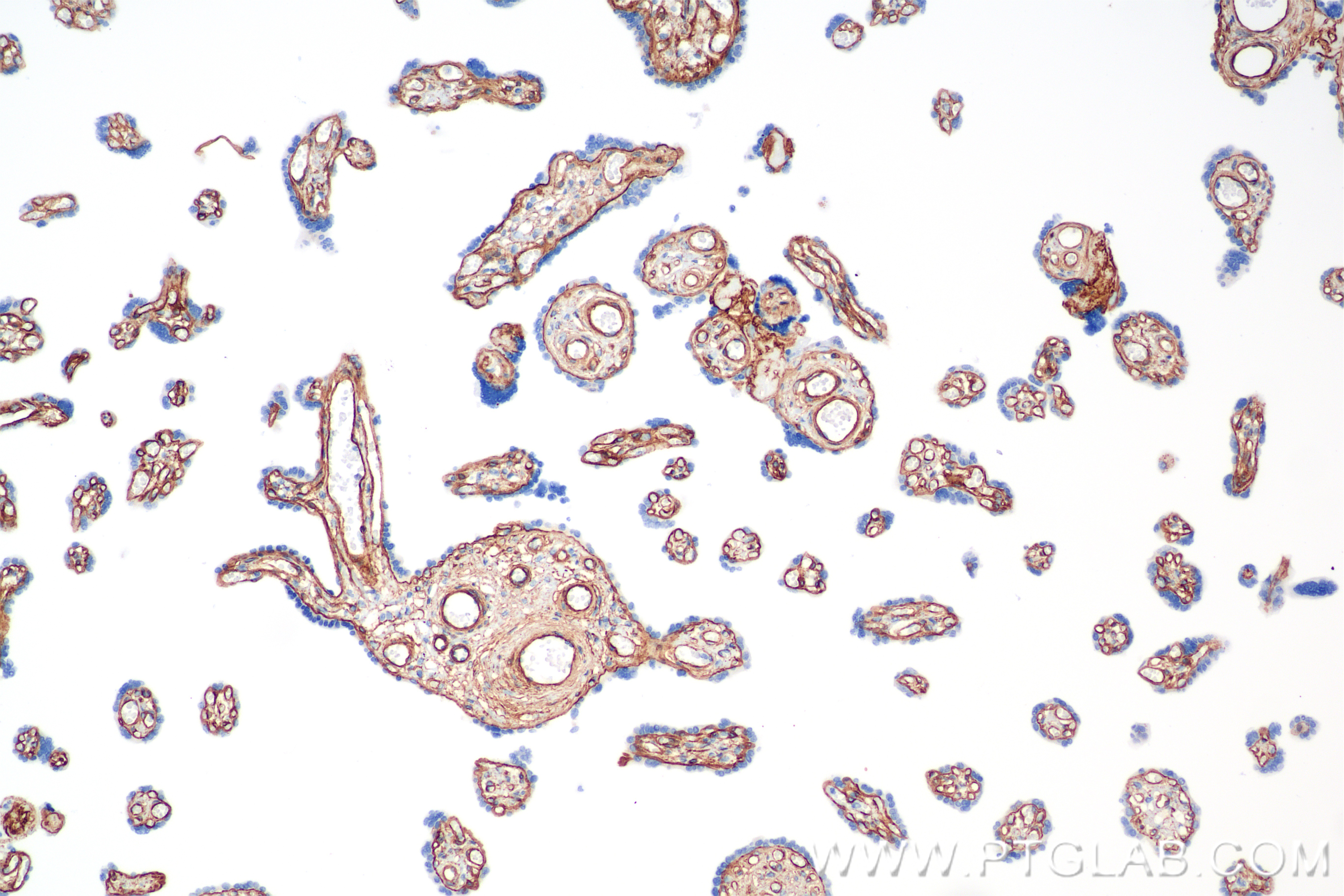 Immunohistochemical analysis of paraffin-embedded human placenta tissue slide using <a class='green' href='/productredirect?CatalogNo=85256-4-RR' target='_blank'>85256-4-RR</a> (COL4A1 antibody) at dilution of 1:1500 (under 10x lens). Heat mediated antigen retrieval with Tris-EDTA buffer (pH 9.0). This data was developed using the same antibody clone with 85256-4-PBS in a different storage buffer formulation. IHC staining of human placenta using 85256-4-RR (same clone as 85256-4-PBS)