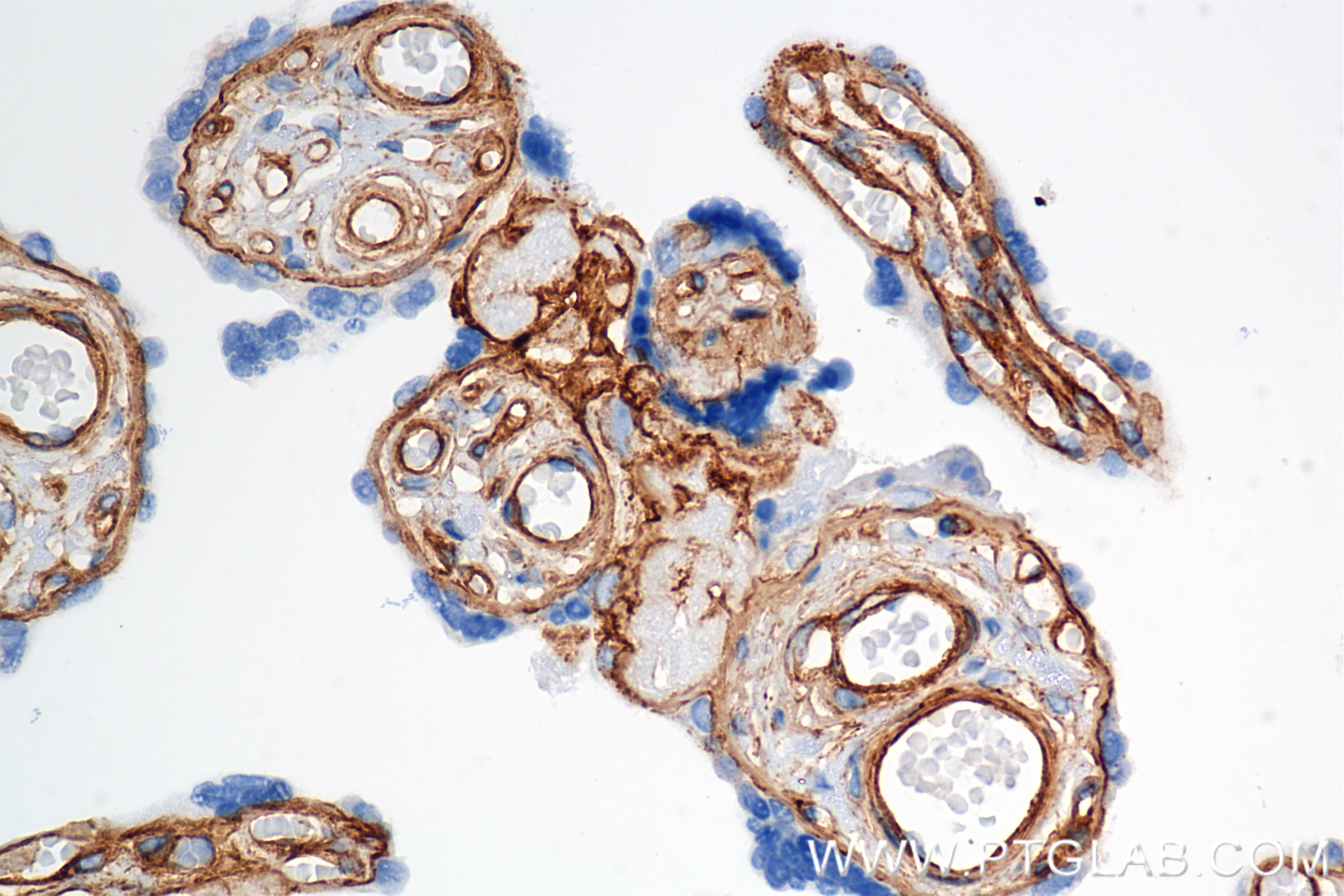 Immunohistochemical analysis of paraffin-embedded human placenta tissue slide using <a class='green' href='/productredirect?CatalogNo=85256-4-RR' target='_blank'>85256-4-RR</a> (COL4A1 antibody) at dilution of 1:1500 (under 40x lens). Heat mediated antigen retrieval with Tris-EDTA buffer (pH 9.0). This data was developed using the same antibody clone with 85256-4-PBS in a different storage buffer formulation. IHC staining of human placenta using 85256-4-RR (same clone as 85256-4-PBS)