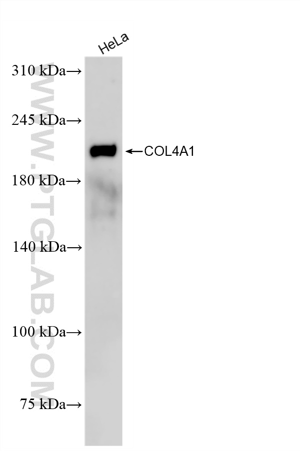 HeLa cells were subjected to SDS PAGE followed by western blot with <a class='green' href='/productredirect?CatalogNo=85256-4-RR' target='_blank'>85256-4-RR</a> (COL4A1 antibody) at dilution of 1:2000 incubated at room temperature for 1.5 hours. This data was developed using the same antibody clone with 85256-4-PBS in a different storage buffer formulation. WB analysis of HeLa using 85256-4-RR (same clone as 85256-4-PBS)