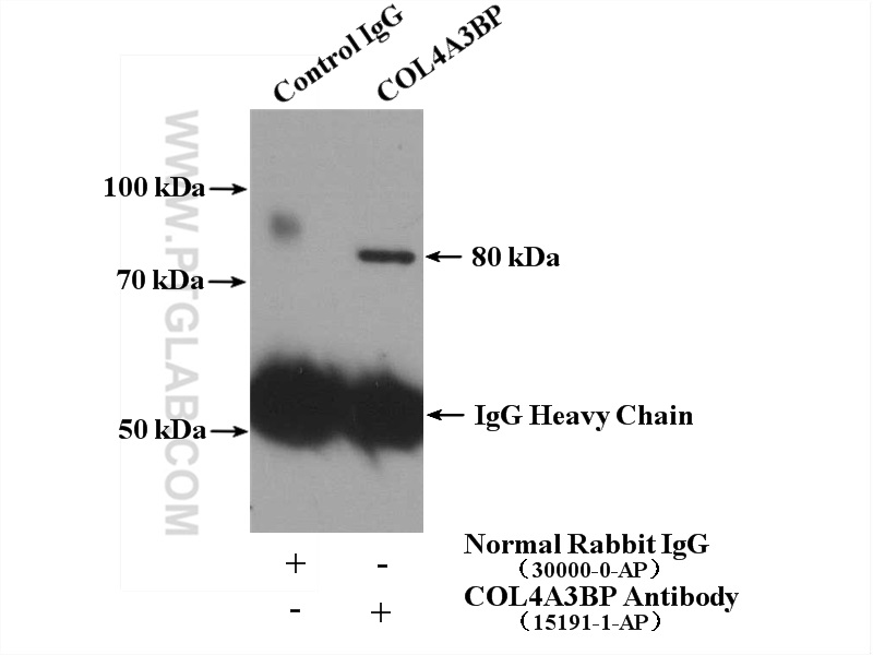 IP experiment of mouse brain using 15191-1-AP