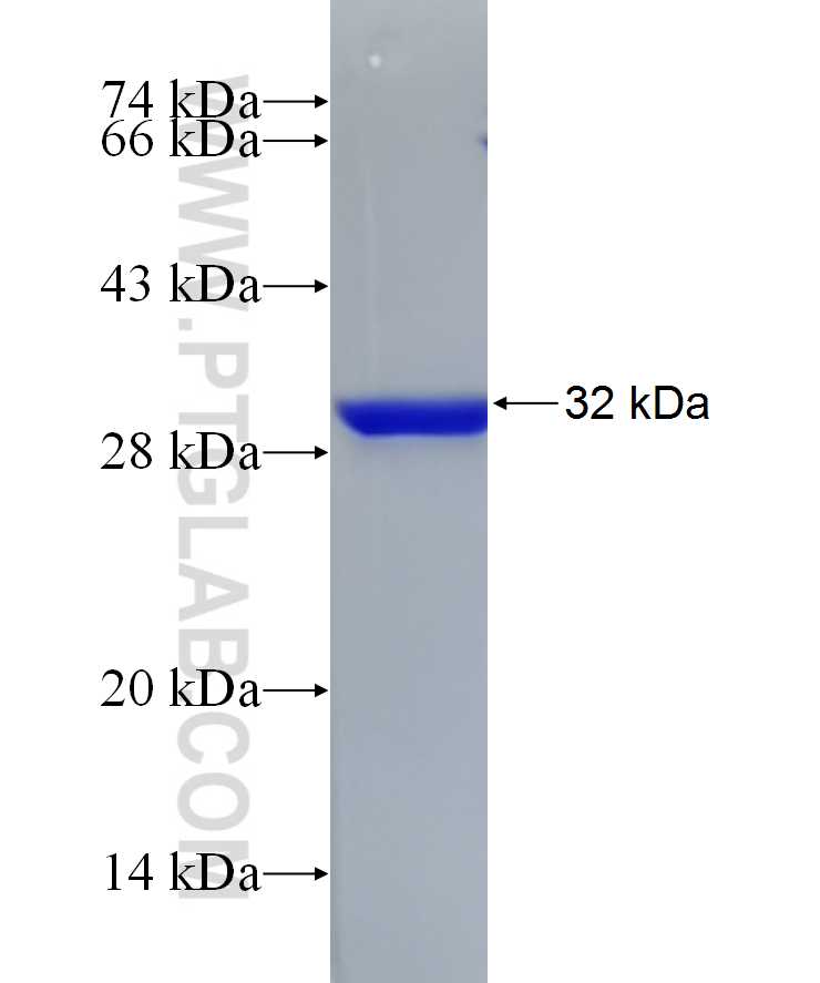 COL4A5 fusion protein Ag25084 SDS-PAGE COL4A5 fusion protein Ag25084 SDS-PAGE