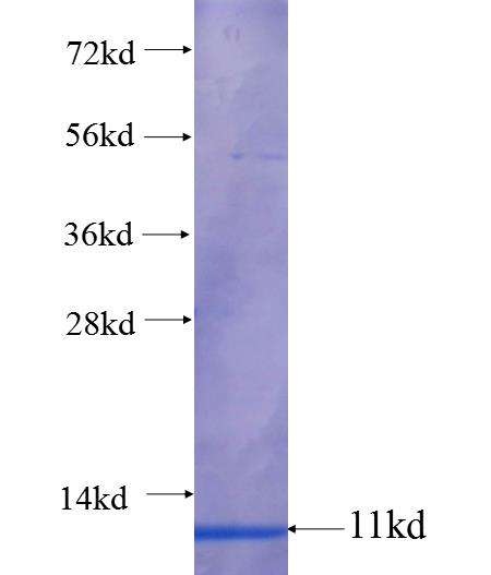 COL4A5 fusion protein Ag25105 SDS-PAGE