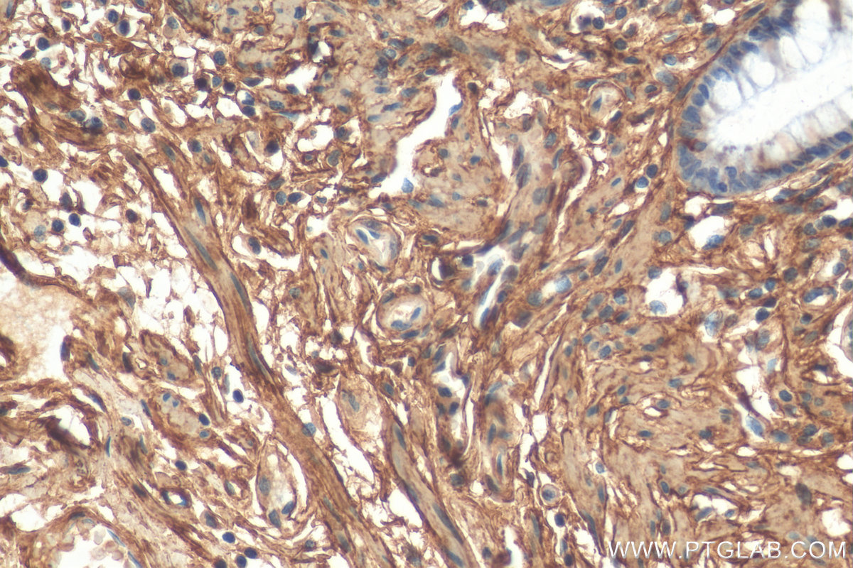 IHC staining of human colon using 17023-1-AP