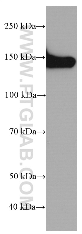 WB analysis of human skeletal muscle using 66824-1-Ig