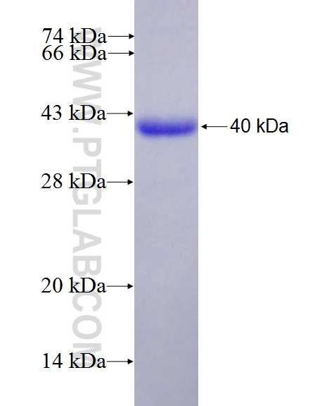 COL6A1 fusion protein Ag11809 SDS-PAGE
