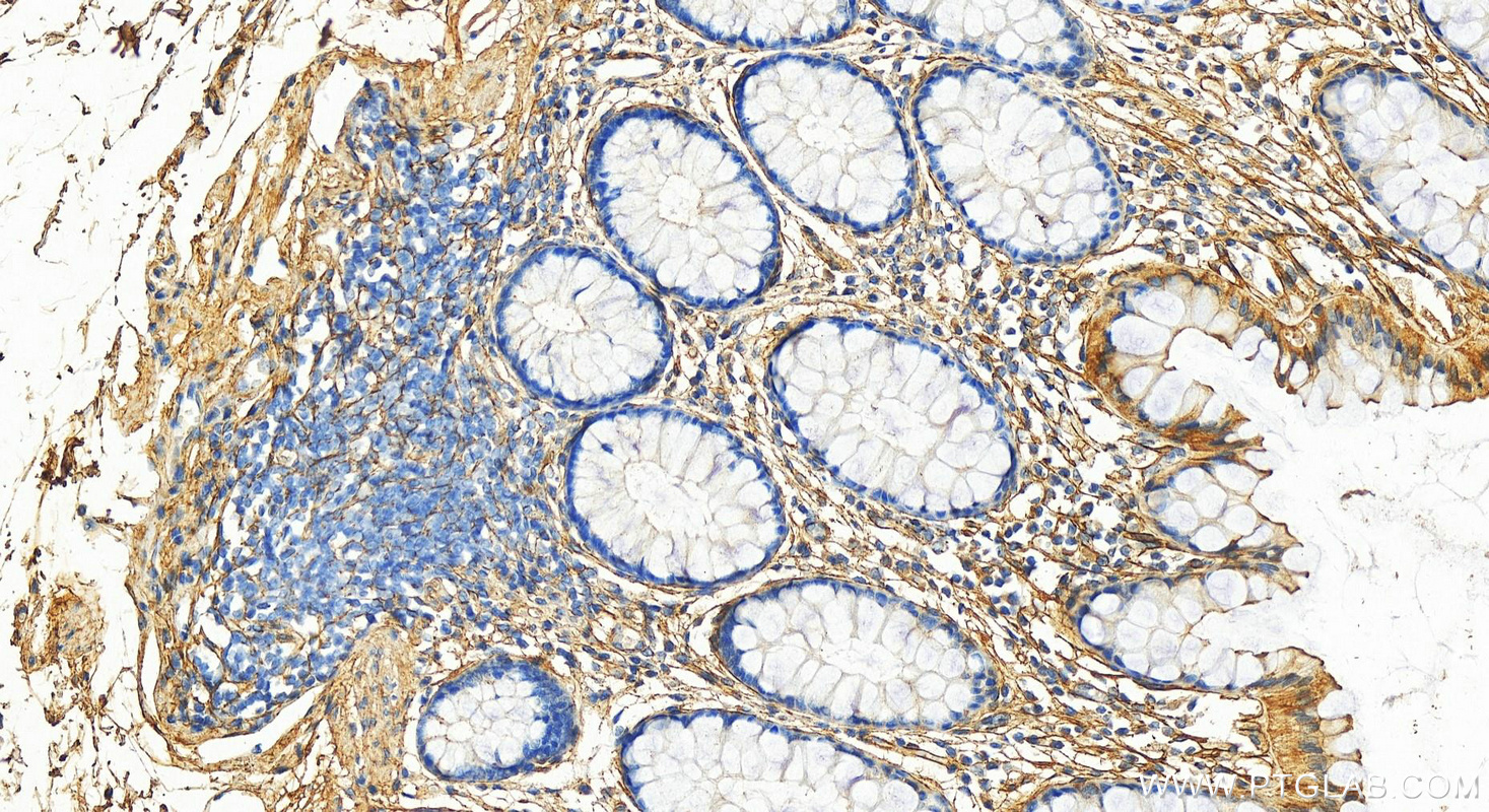 IHC staining of human colon using 14853-1-AP