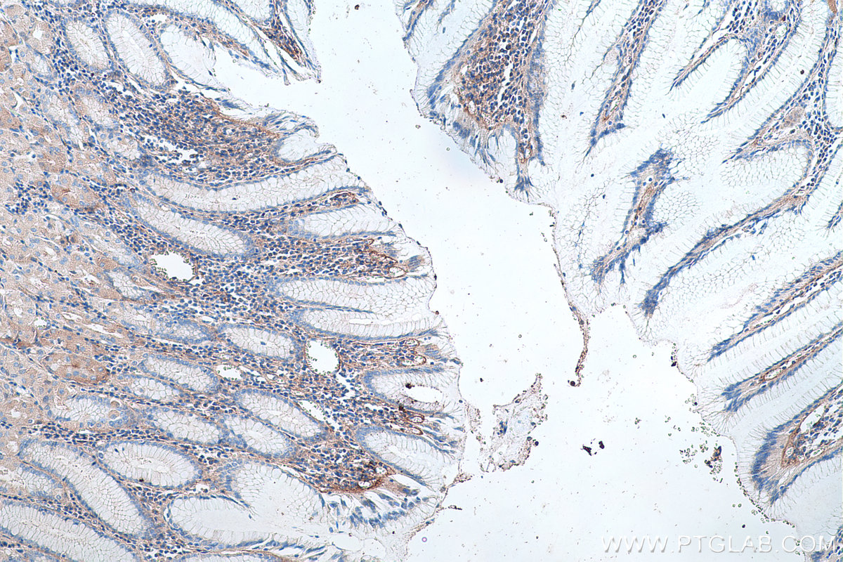 IHC staining of human stomach using 14853-1-AP
