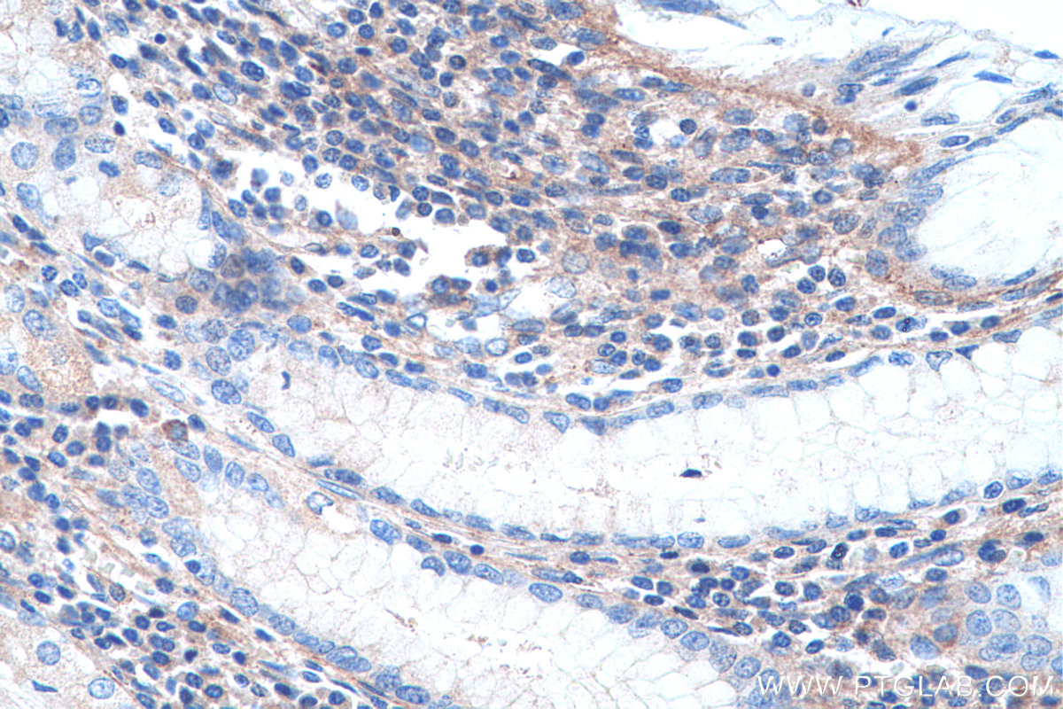 IHC staining of human stomach using 14853-1-AP