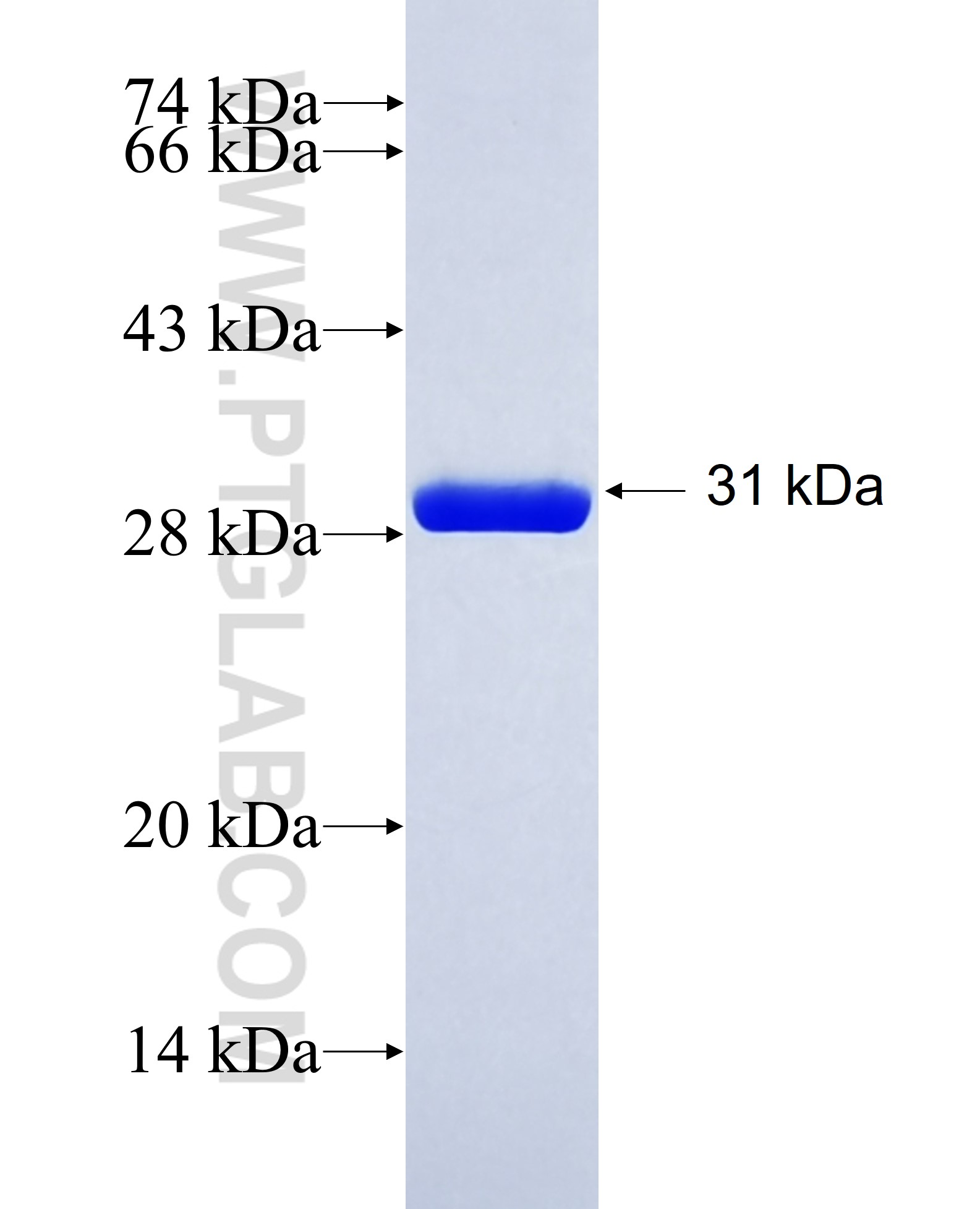 COL6A3 fusion protein Ag35162 SDS-PAGE
