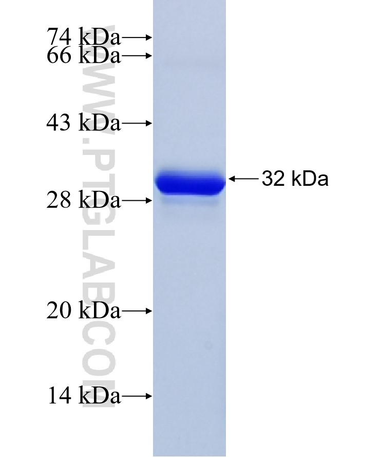 COL6A3-Specific fusion protein Ag34777 SDS-PAGE COL6A3-Specific fusion protein Ag34777 SDS-PAGE
