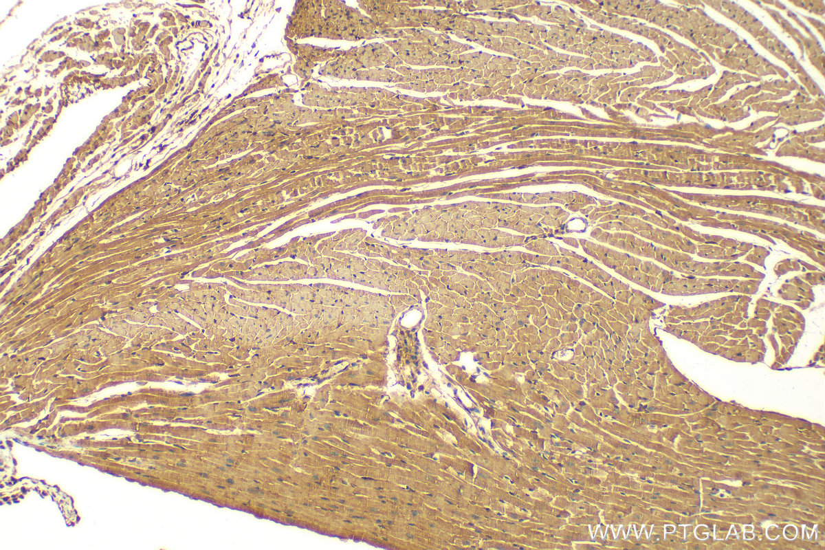 IHC staining of mouse heart using 22302-1-AP