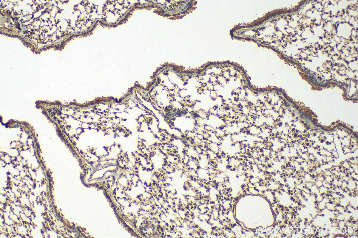 IHC staining of mouse lung using 22302-1-AP