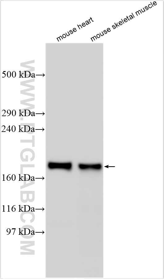 WB analysis using 22302-1-AP