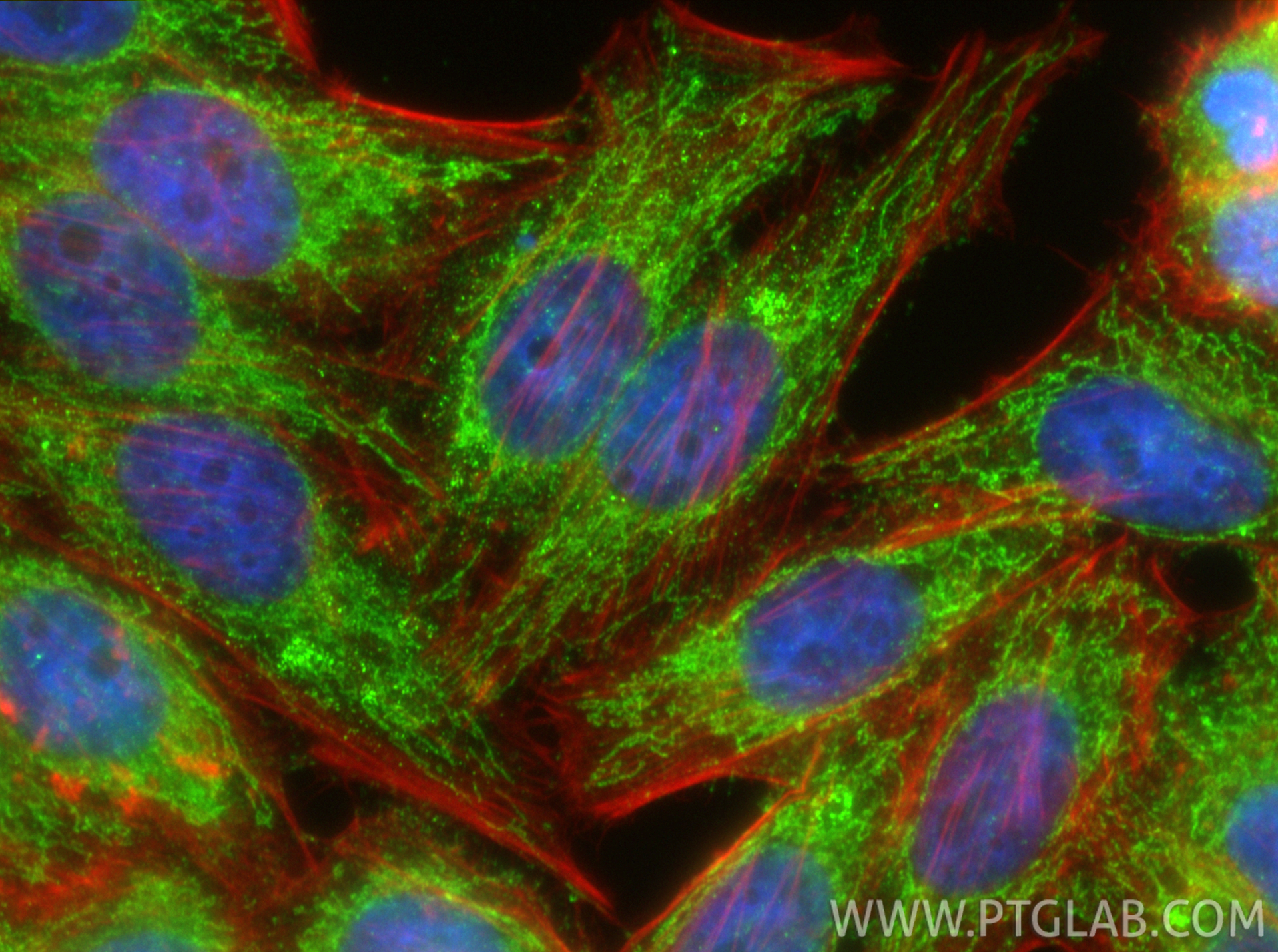Immunofluorescent analysis of (4% PFA) fixed HepG2 cells using COL8A1 antibody (17251-1-AP) at dilution of 1:400 and CoraLite®488-Conjugated Goat Anti-Rabbit IgG(H+L) (<a class='green' href='/productredirect?CatalogNo=SA00013-2' target='_blank'>SA00013-2</a>), CL594-Phalloidin (red). IF Staining of HepG2 using 17251-1-AP