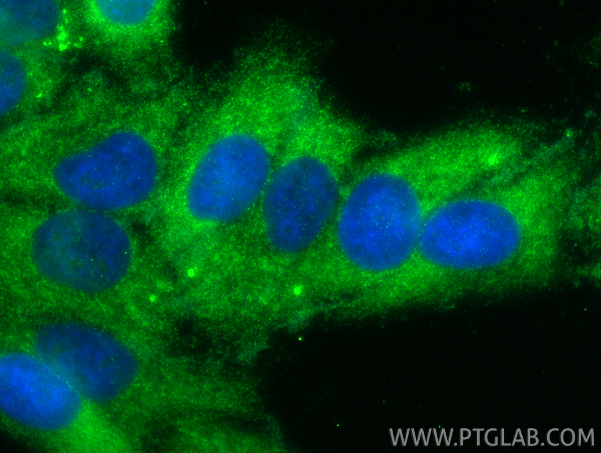 Immunofluorescent analysis of (-20°C Ethanol) fixed HepG2 cells using COL8A1 antibody (17251-1-AP) at dilution of 1:400 and CoraLite®488-Conjugated Goat Anti-Rabbit IgG(H+L) (<a class='green' href='/productredirect?CatalogNo=SA00013-2' target='_blank'>SA00013-2</a>). IF Staining of HepG2 using 17251-1-AP