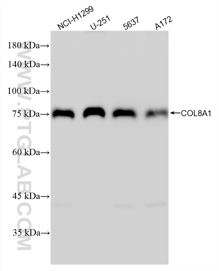WB analysis using 87280-1-RR (same clone as 87280-1-PBS)