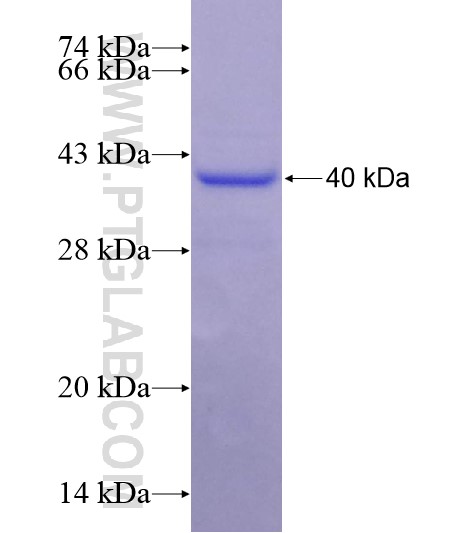 COL9A1 fusion protein Ag28633 SDS-PAGE