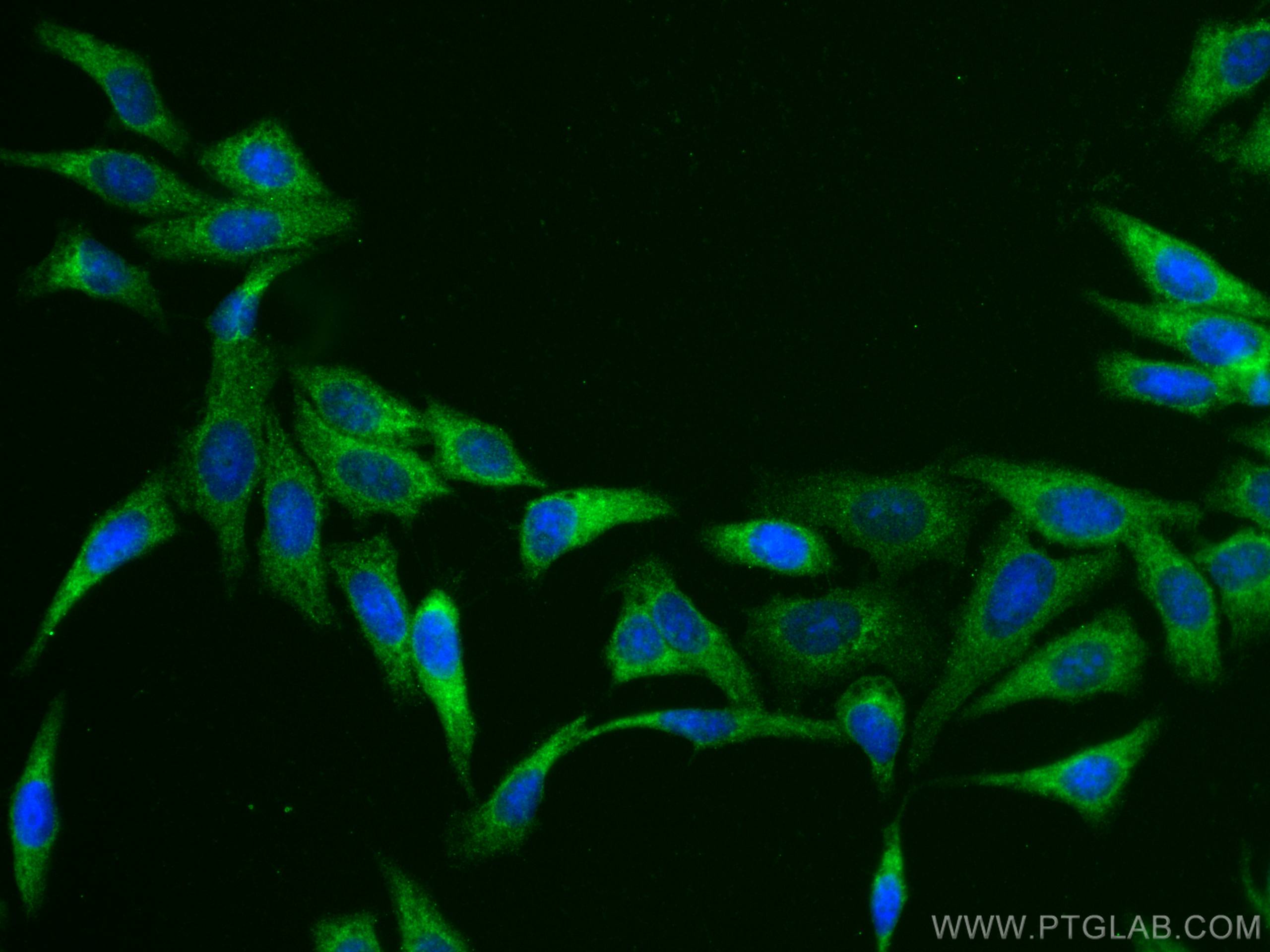 IF Staining of HepG2 using 11938-1-AP