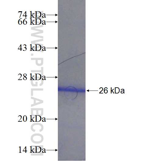 COMMD3 fusion protein Ag24099 SDS-PAGE