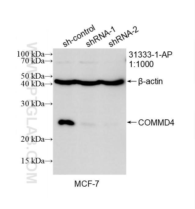 WB analysis of MCF-7 using 31333-1-AP