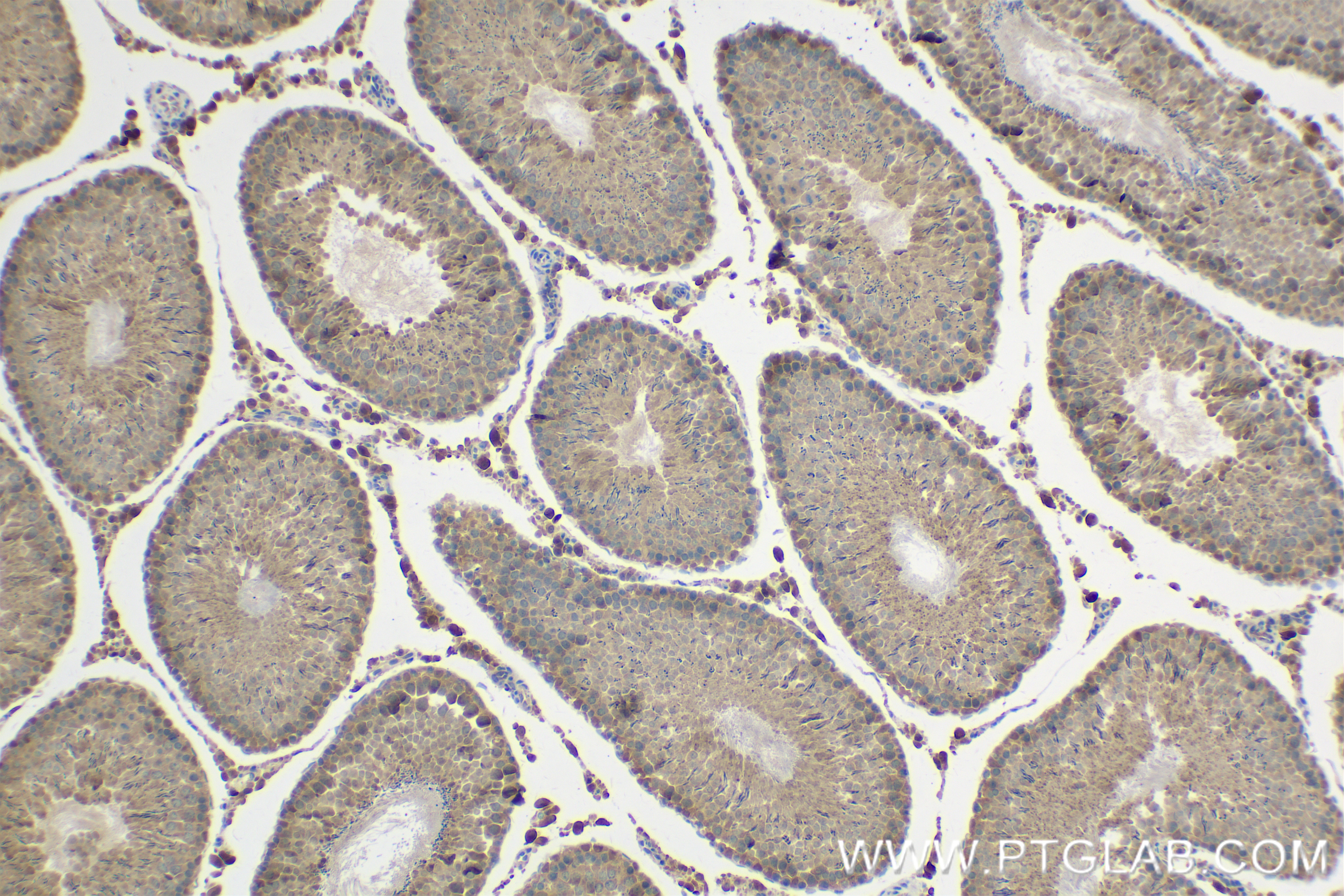 IHC staining of rat testis using 84664-4-RR