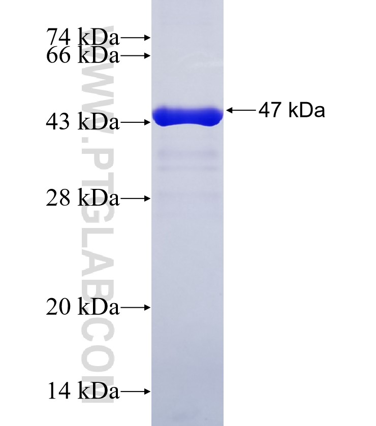 COMMD4 fusion protein Ag34904 SDS-PAGE